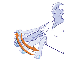 Osteoarthritis of the shoulder-Established osteoarthritis