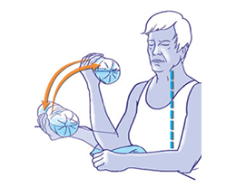 Osteoarthritis of the elbow-Established osteoarthritis