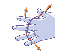 Osteoarthritis of the fingers and wrists-established osteoarthritis