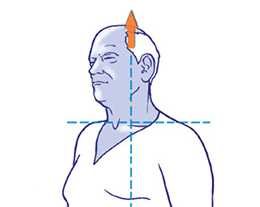 Osteoarthritis of the cervical spine-established osteoarthritis